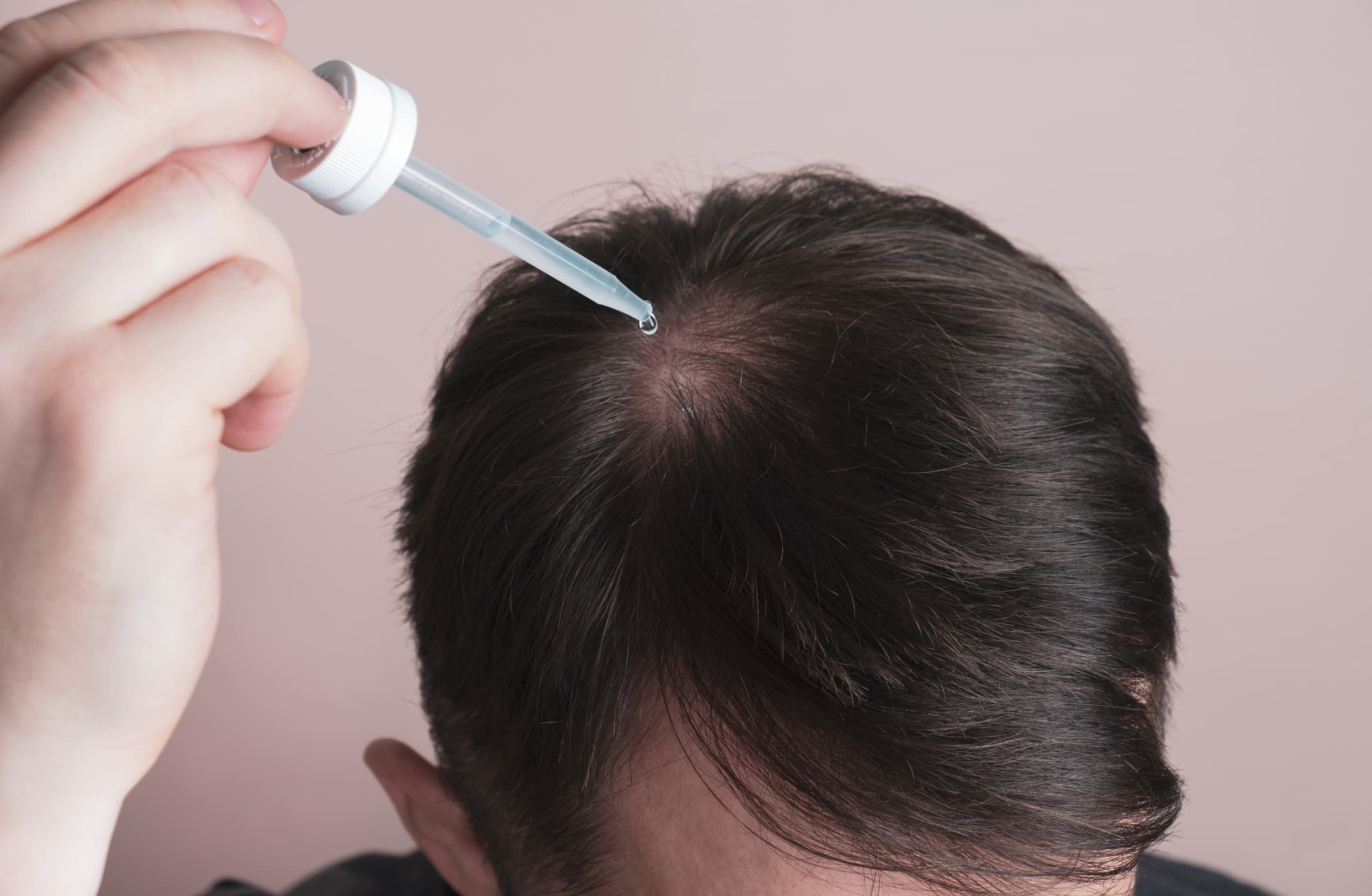 best hair loss treatment review