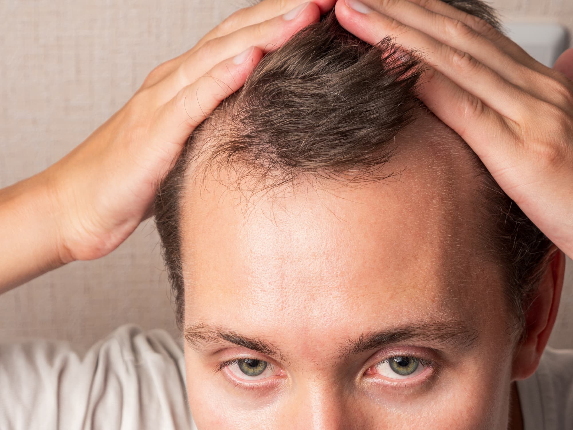 Happy Head vs. Hims vs. Keeps: Best & Worst ways to regrow hair!