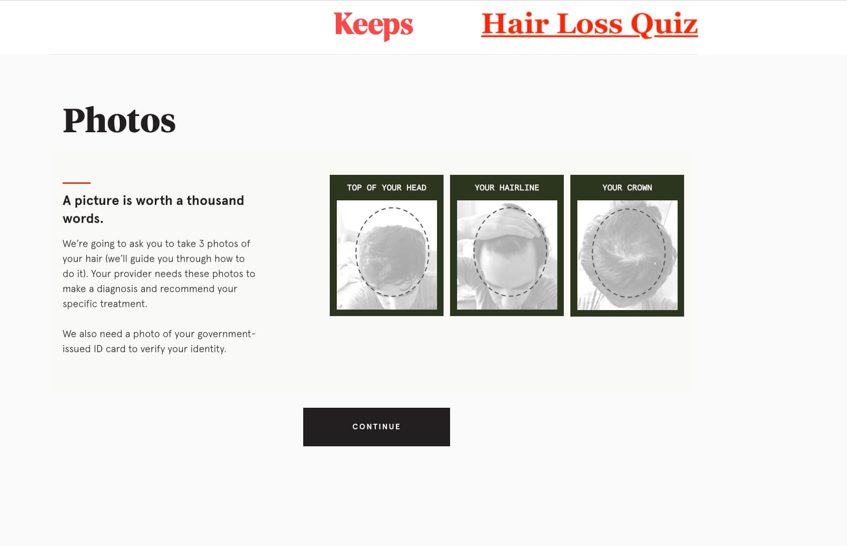 how to choose keeps hair loss treatment 