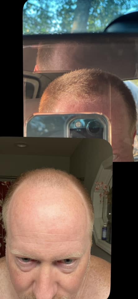 happy head before and after picture 2