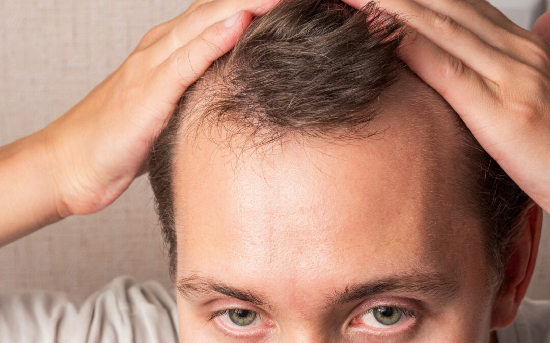 Happy Head vs. Hims vs. Keeps: Best & Worst ways to regrow hair!